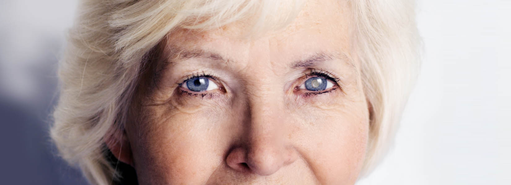 Cataract Surgery in Pittsburgh